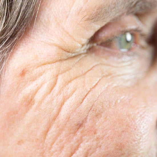 Actinic Keratosis clinical study in Bowling Green KY