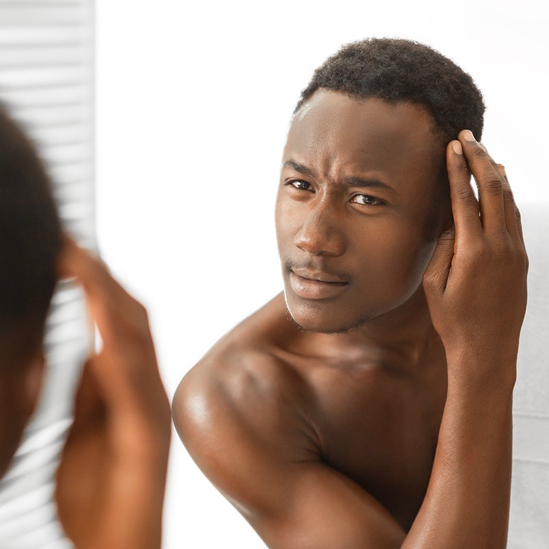 Dandruff clinical trial in Kentucky or New York