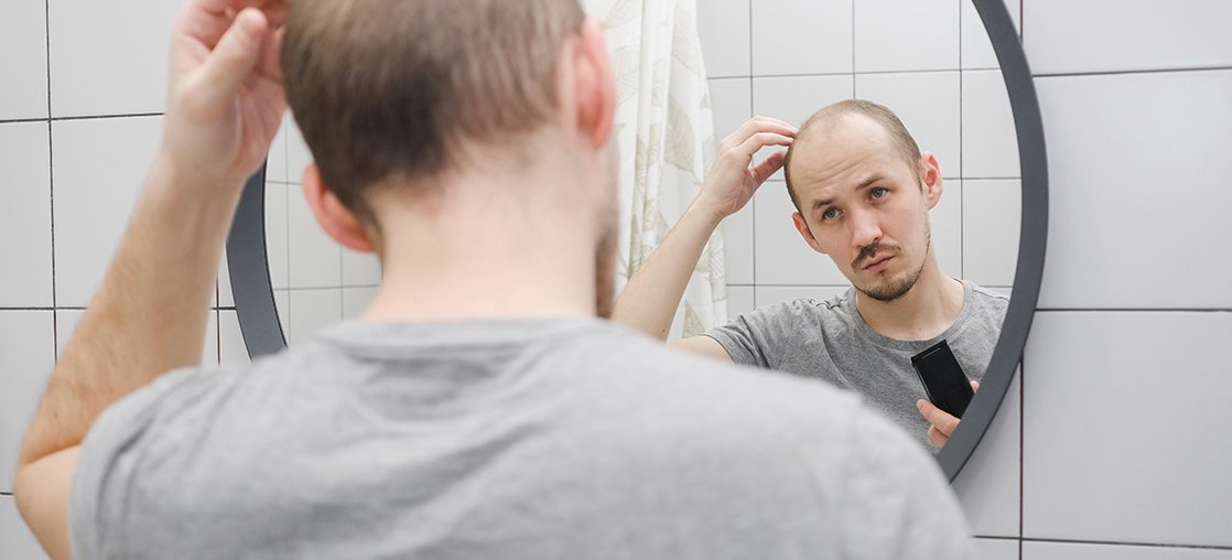 Hair Loss (Alopecia) study in Bowling Green KY