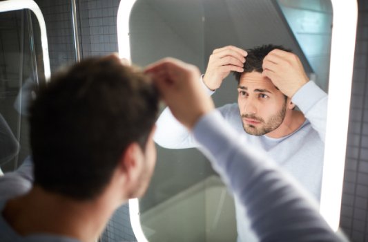 Hair Loss Alopecia