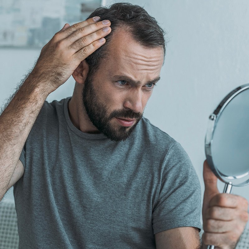 Join an alopecia clinical trial in Kentucky or New York