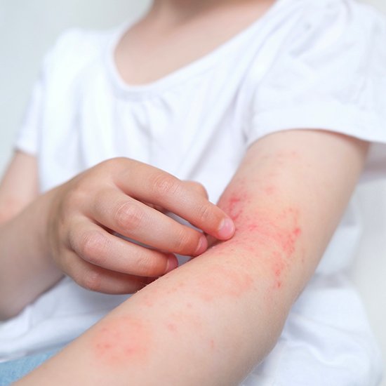 Psoriasis clinical study in Bowling Green KY