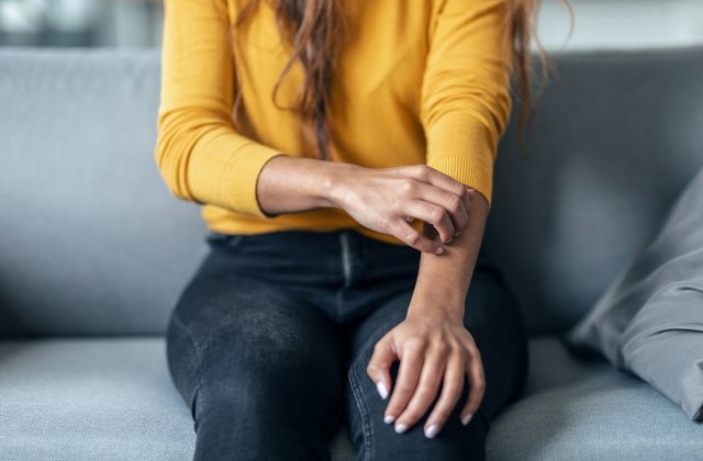 Psoriasis