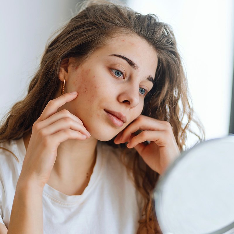 Rosacea Clinical Trial in Kentucky or New York