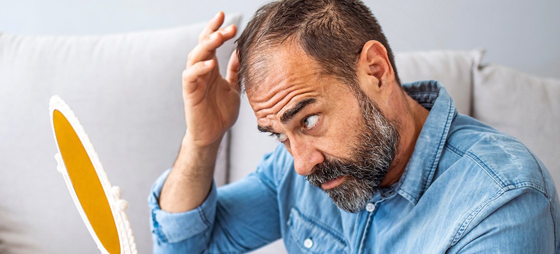 Scarring Alopecias treated in New York NY