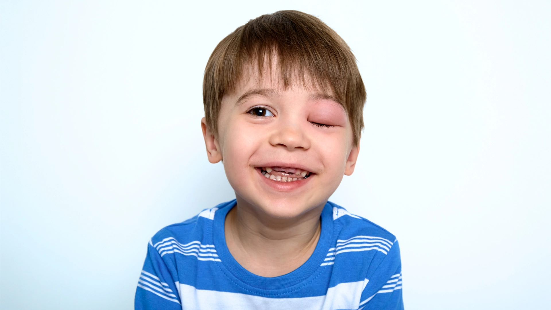 HAE Hereditary angioedema clinical trials ran by Equity Medical offering potential treatment in Kentucky and New York