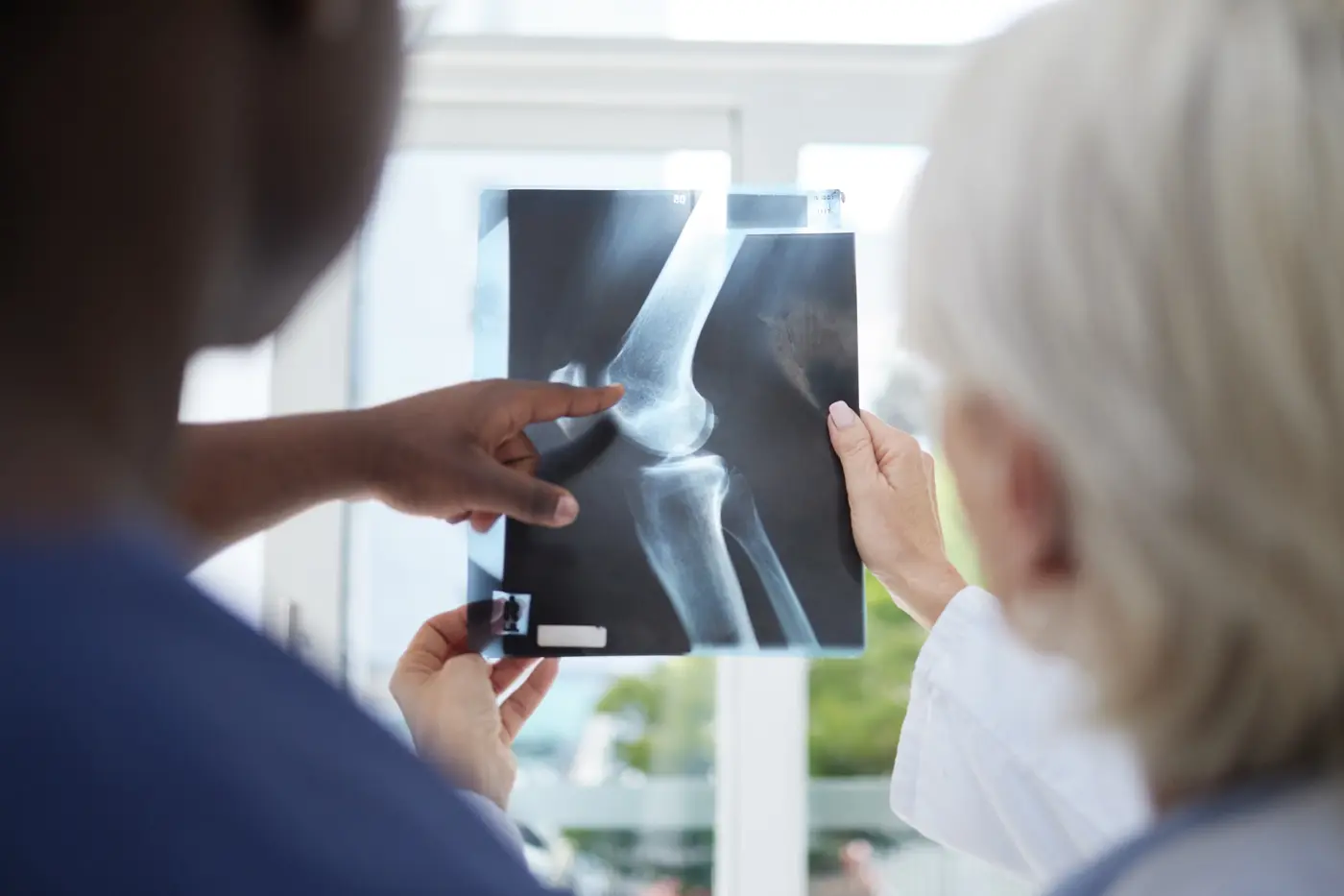 Doctor reviewing knee X-ray for osteoarthritis clinical trials evaluation at a clinical research center