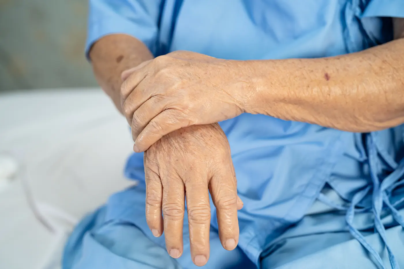 Close-up of older adult with rheumatoid arthritis experiencing hand and joint pain