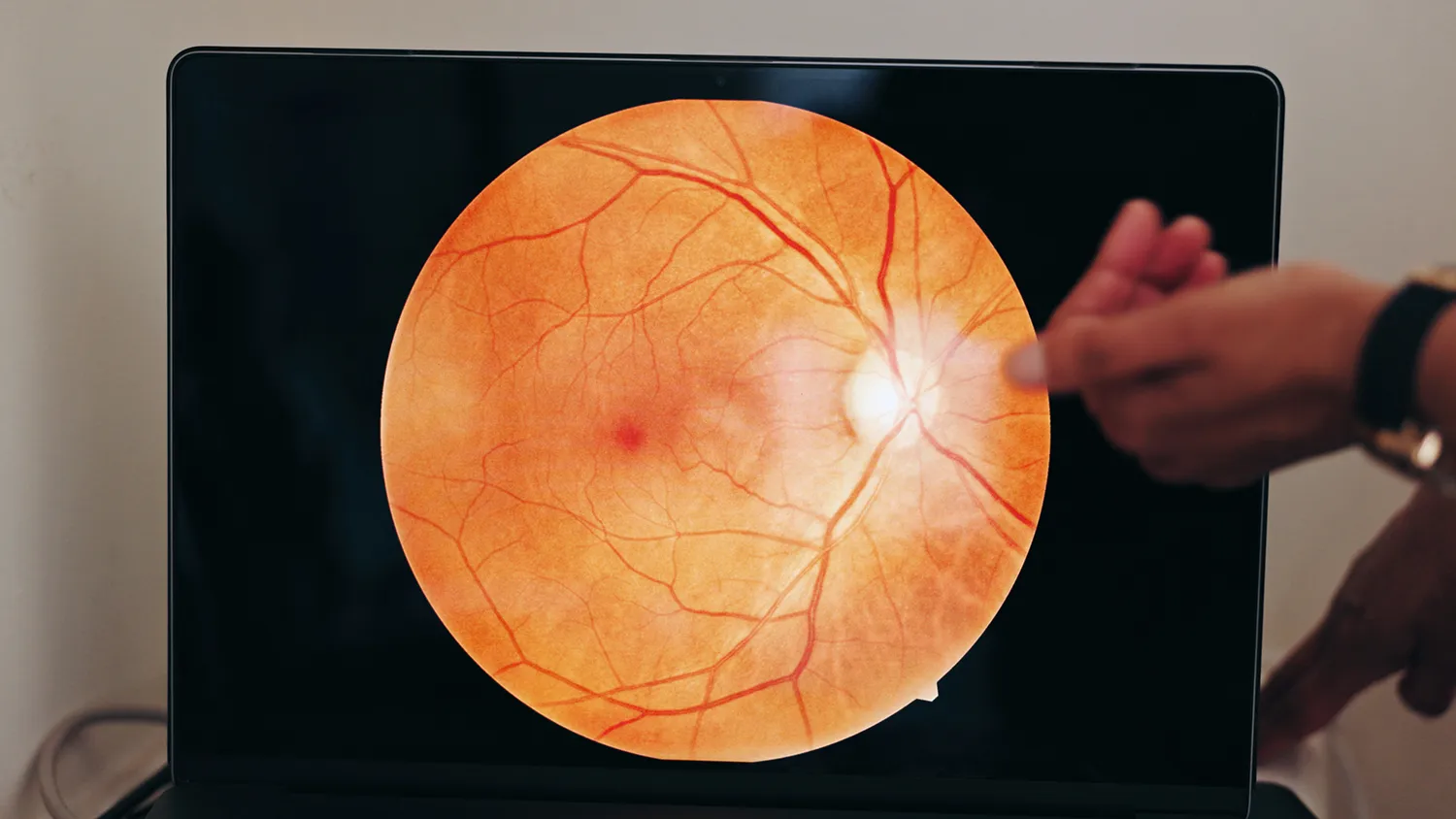 Retina scan used to evaluate patients for inherited retinal diseases clinical trials at Equity Medical.